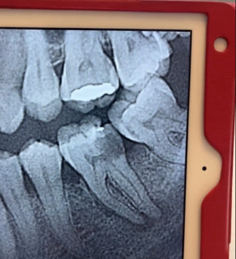 Endoontia